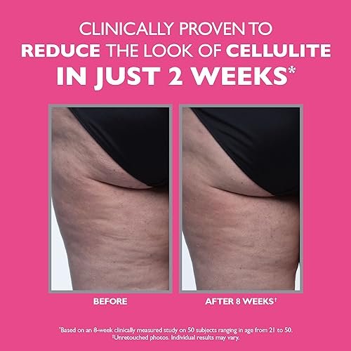 Peter Thomas Roth FIRMx Tight & Toned Cellulite Treatment Body Cream - Clinically Proven to Reduce Cellulite in 2 Weeks Avelisse