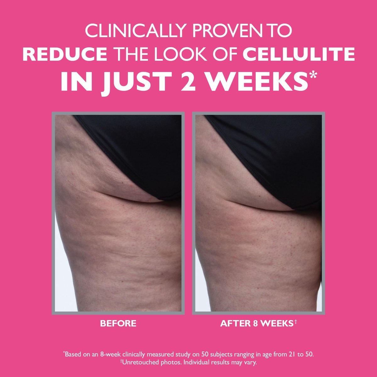 Peter Thomas Roth FIRMx Tight & Toned Cellulite Treatment Body Cream - Clinically Proven to Reduce Cellulite in 2 Weeks Avelisse