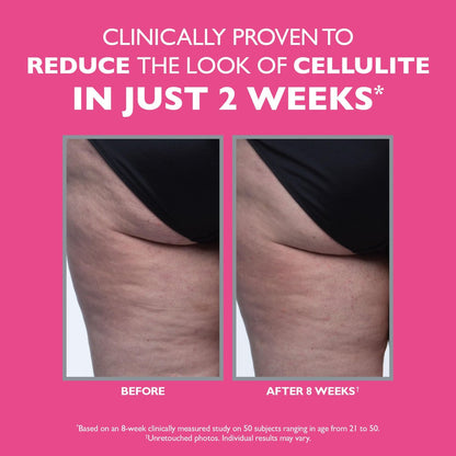Peter Thomas Roth FIRMx Tight & Toned Cellulite Treatment Body Cream - Clinically Proven to Reduce Cellulite in 2 Weeks Avelisse