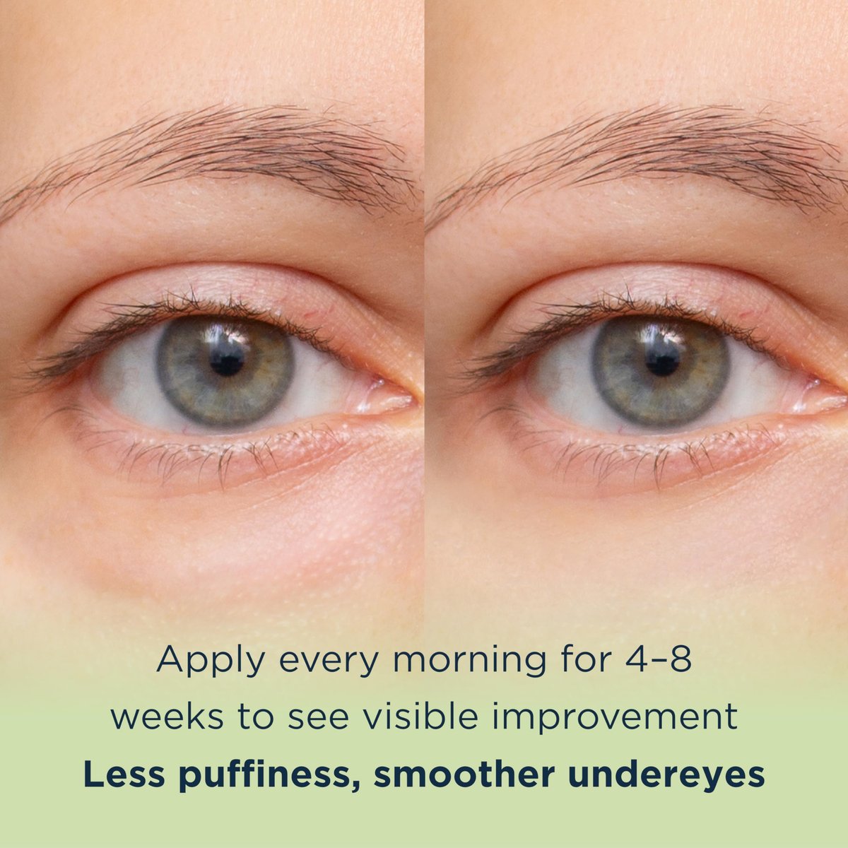 MATKAS Korean Vitamin C Under Eye Cream for Dark Circles and Puffiness 0.5 Fl. Oz. - Brightening Under Eye Cream with Caffeine for Puffy Eyes, Korean Under Eyes Brightener Moisturizer - görsel 11