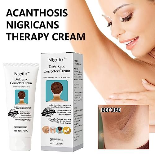 Nigrifix Acanthosis Nigricans Therapy Cream – Dark Spot Remover for Body, Underarm, Neck, Armpit, Knees, Elbows, Private Areas – Upgraded Formula, 2.1 Fl Oz Avelisse