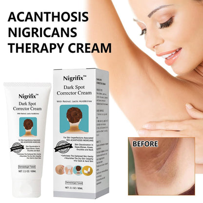 Nigrifix Acanthosis Nigricans Therapy Cream – Dark Spot Remover for Body, Underarm, Neck, Armpit, Knees, Elbows, Private Areas – Upgraded Formula, 2.1 Fl Oz Avelisse