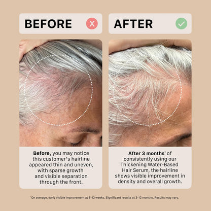 ACTIIV Thickening Hair Serum - Water Based | Supports Thicker, Fuller-Looking Hair, Lightweight Non-Greasy Formula for All Hair Types, 1.8 oz Avelisse