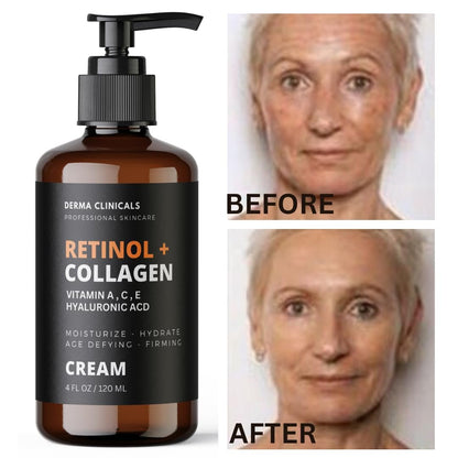 Retinol + Collagen Anti-Aging Face Cream with Hyaluronic Acid, Vitamin C - Day and Night Moisturizer for Wrinkles and Firming - 4 oz Avelisse
