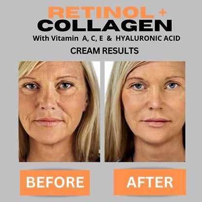 Retinol + Collagen Anti-Aging Face Cream with Hyaluronic Acid, Vitamin C - Day and Night Moisturizer for Wrinkles and Firming - 4 oz Avelisse