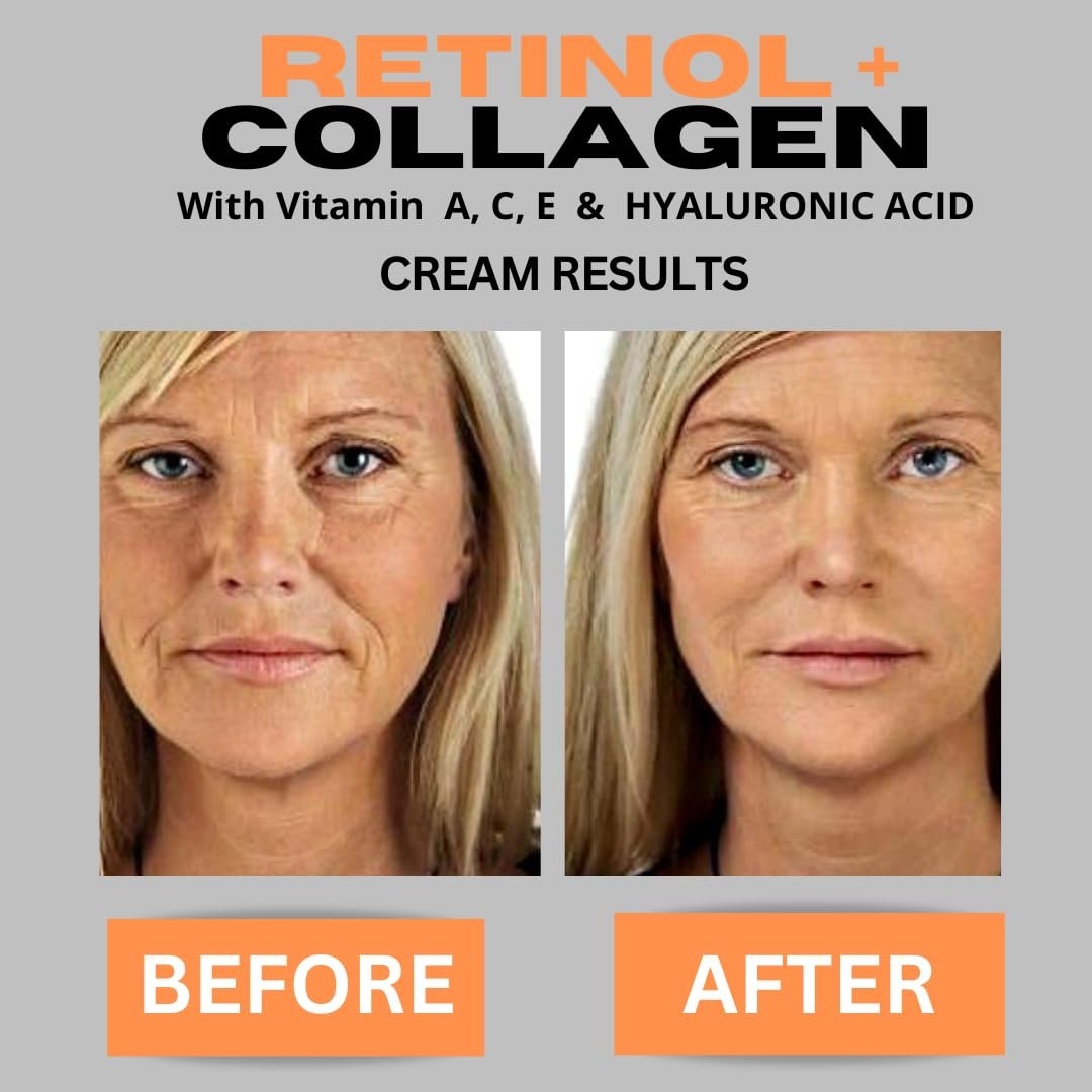 Retinol + Collagen Anti-Aging Face Cream with Hyaluronic Acid, Vitamin C - Day and Night Moisturizer for Wrinkles and Firming - 4 oz Avelisse