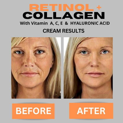 Retinol + Collagen Anti-Aging Face Cream with Hyaluronic Acid, Vitamin C - Day and Night Moisturizer for Wrinkles and Firming - 4 oz Avelisse