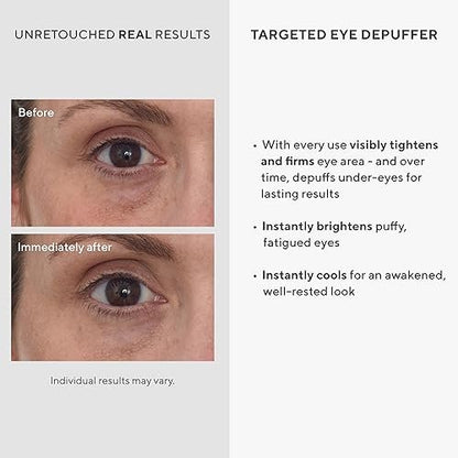 Murad Targeted Eye Depuffer – Ginseng, Lily & Caffeine Eye Cream for Brightening, Depuffing & Firming Under-Eye Bags – 0.5 Fl Oz Avelisse