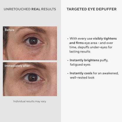 Murad Targeted Eye Depuffer – Ginseng, Lily & Caffeine Eye Cream for Brightening, Depuffing & Firming Under-Eye Bags – 0.5 Fl Oz Avelisse
