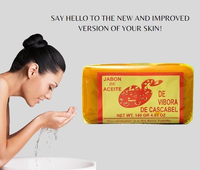 Rattlesnake Oil Soap (140g) – Face & Body Bar for Acne & Melasma Removal Avelisse