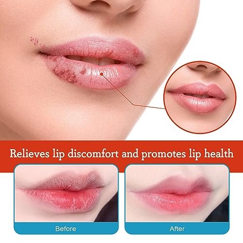 Dry Cracked Lips - Natural Healing Lip Balm, Organic All-Day Moisture Cheilitis Treatment Cream - Men, Women & Children, Dermatologist Recommended - görsel 4