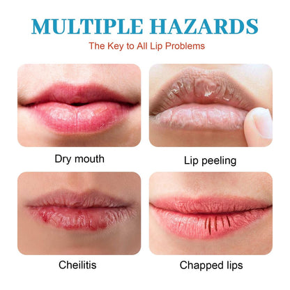 Dry Cracked Lips - Natural Healing Lip Balm, Organic All-Day Moisture Cheilitis Treatment Cream - Men, Women & Children, Dermatologist Recommended