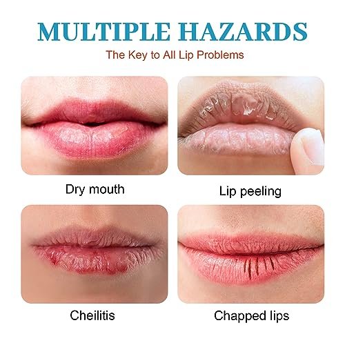 Dry Cracked Lips - Natural Healing Lip Balm, Organic All-Day Moisture Cheilitis Treatment Cream - Men, Women & Children, Dermatologist Recommended - görsel 10