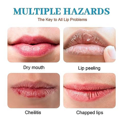 Dry Cracked Lips - Natural Healing Lip Balm, Organic All-Day Moisture Cheilitis Treatment Cream - Men, Women & Children, Dermatologist Recommended