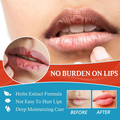 Dry Cracked Lips - Natural Healing Lip Balm, Organic All-Day Moisture Cheilitis Treatment Cream - Men, Women & Children, Dermatologist Recommended