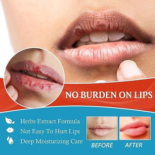 Dry Cracked Lips - Natural Healing Lip Balm, Organic All-Day Moisture Cheilitis Treatment Cream - Men, Women & Children, Dermatologist Recommended - görsel 6