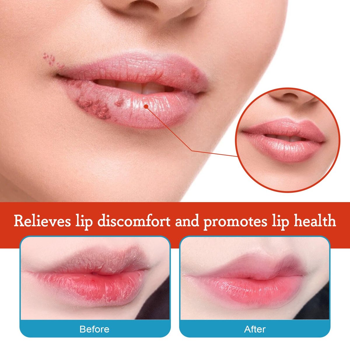 Dry Cracked Lips - Natural Healing Lip Balm, Organic All-Day Moisture Cheilitis Treatment Cream - Men, Women & Children, Dermatologist Recommended - görsel 3