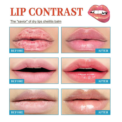 Dry Cracked Lips - Natural Healing Lip Balm, Organic All-Day Moisture Cheilitis Treatment Cream - Men, Women & Children, Dermatologist Recommended