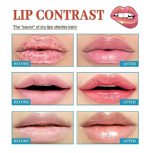 Dry Cracked Lips - Natural Healing Lip Balm, Organic All-Day Moisture Cheilitis Treatment Cream - Men, Women & Children, Dermatologist Recommended - görsel 8