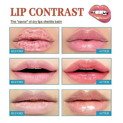 Dry Cracked Lips - Natural Healing Lip Balm, Organic All-Day Moisture Cheilitis Treatment Cream - Men, Women & Children, Dermatologist Recommended