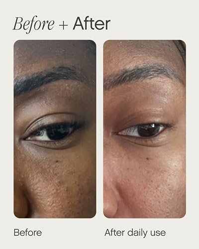 Topicals Sealed Active Scar Filling Primer for Acne Prone Skin - Retinol & Salicylic Acid - 1 Oz Avelisse