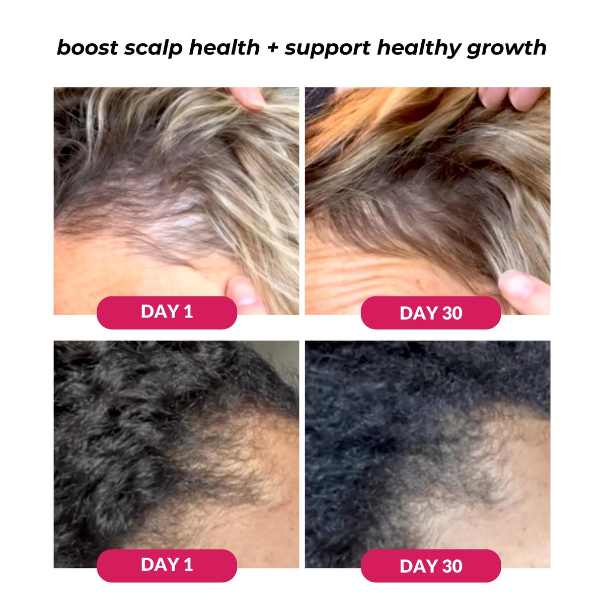 Love Ur Curls Healthy Scalp Serum – Turmeric & Basil Hair Growth Activator for Thicker, Fuller Hair, Vegan, 1.7 oz Avelisse
