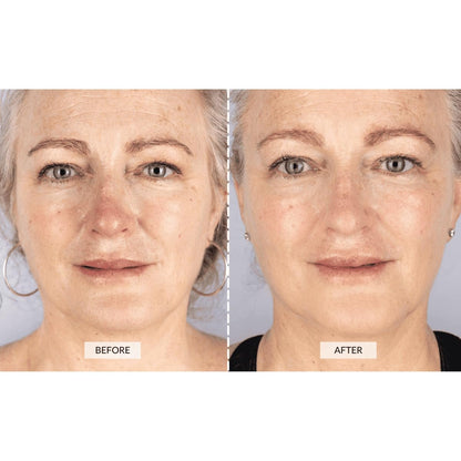 CurrentBody Skin LED Light Therapy Face Mask Series 1 - Red Light Anti-Aging Device for Wrinkle Reduction Avelisse