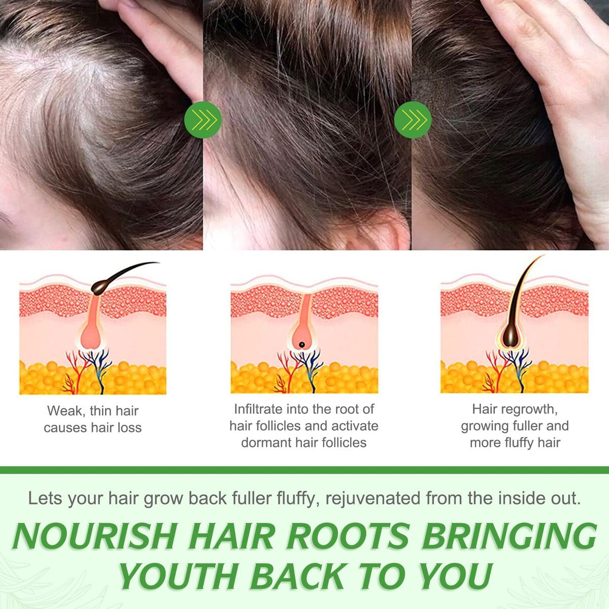 ELBBUB 100% Pure Rosemary Essential Oil for Hair Growth & Skin Care - 60ml (2 Fl Oz) Nourishes Scalp, Stimulates Hair Regrowth for Men & Women Avelisse