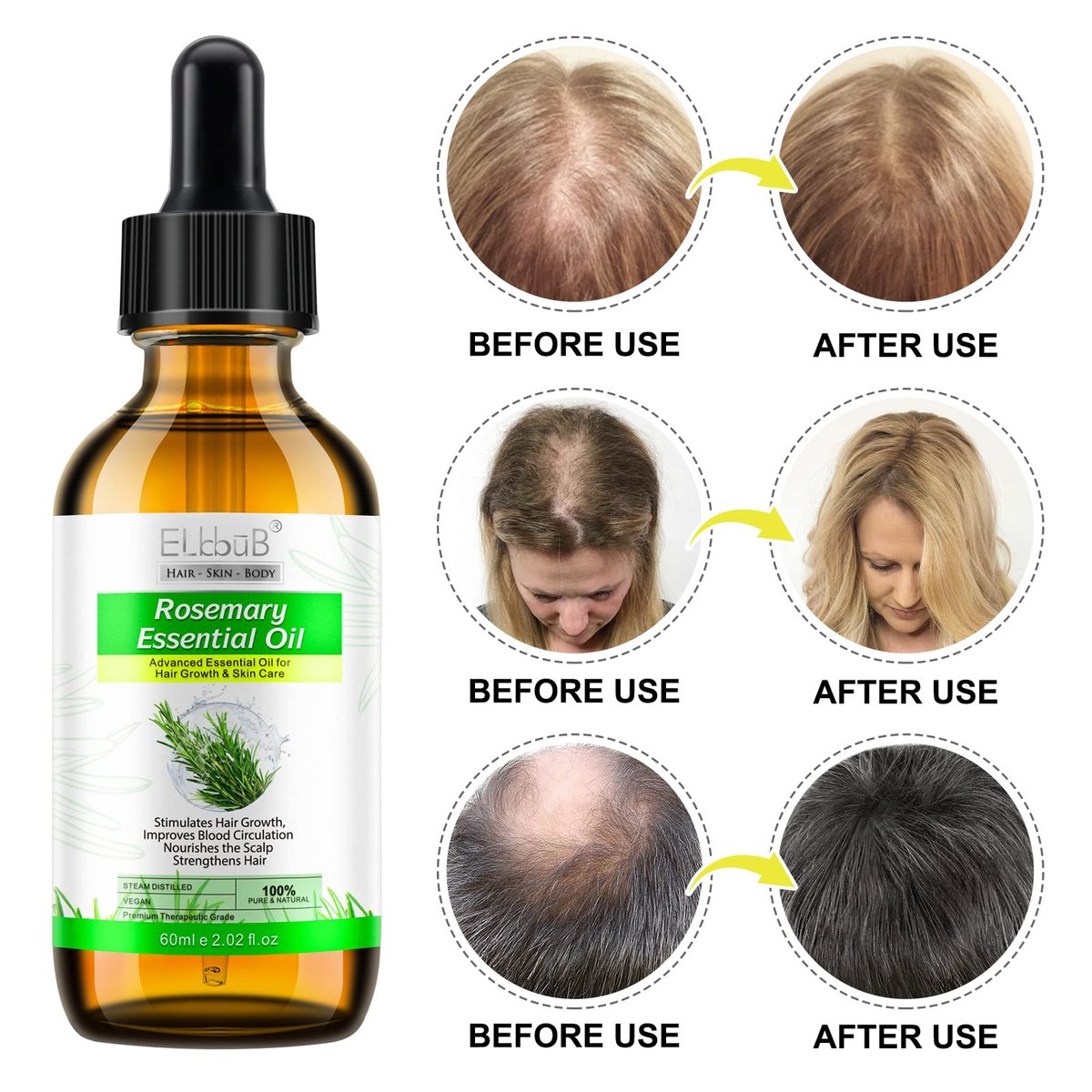 ELBBUB 100% Pure Rosemary Essential Oil for Hair Growth & Skin Care - 60ml (2 Fl Oz) Nourishes Scalp, Stimulates Hair Regrowth for Men & Women Avelisse