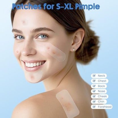 Breiboz Pimple Patches for Face & Body, 331 Patches Variety Pack with Large Sizes, Invisible Hydrocolloid Acne Patch with Tea Tree Oil & Salicylic Acid, Overnight Zit Stickers for Blemishes & Spots, All Skin Types