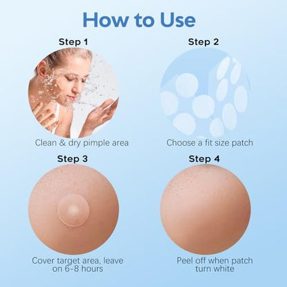 Breiboz Pimple Patches for Face & Body, 331 Patches Variety Pack with Large Sizes, Invisible Hydrocolloid Acne Patch with Tea Tree Oil & Salicylic Acid, Overnight Zit Stickers for Blemishes & Spots, All Skin Types