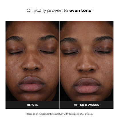 Paula's Choice 25% Vitamin C Serum with Glutathione & Antioxidants | Firming & Brightening Face Serum for All Skin Types | 1 oz Avelisse