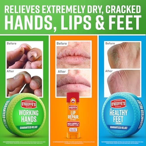 O'Keeffe's Gift Box: Lip Repair with Cherry & Vitamin E, Working Hands, Healthy Feet - 3 Piece Set - görsel 6