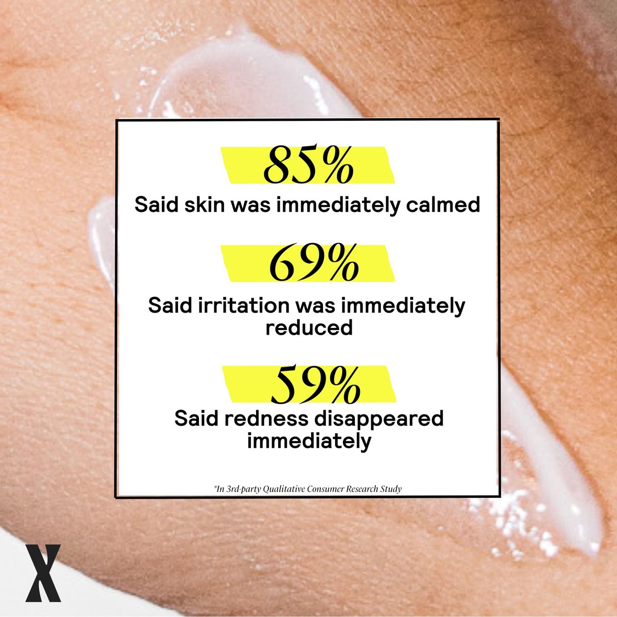 Untoxicated Moisturizing Lotion - Daily Face Moisturizer & Body Lotion for Sensitive Skin with Ceramides & Hyaluronic Acid, Oil-Free, Fragrance-Free, Non-Comedogenic, 10 oz Avelisse