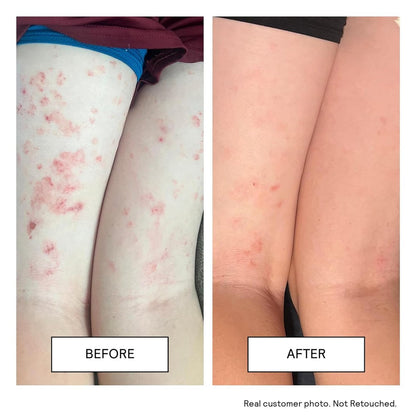 Untoxicated Moisturizing Cream - Face & Body Moisturizer for Sensitive Skin, NEA Approved for Eczema Relief, with Ceramides & Hyaluronic Acid, No Common Irritants, 10 Fl Oz Avelisse