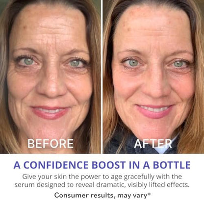 goPure Actives Firm & Lift Serum – Anti-Aging Retinol Serum for Smooth, Glowing Skin with Bakuchiol for Collagen Support, 1 fl oz Avelisse