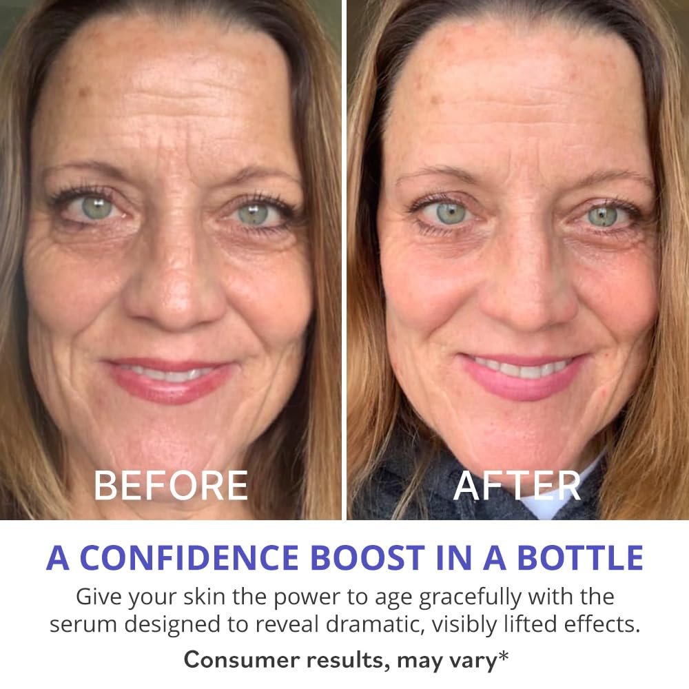 goPure Actives Firm & Lift Serum – Anti-Aging Retinol Serum for Smooth, Glowing Skin with Bakuchiol for Collagen Support, 1 fl oz Avelisse