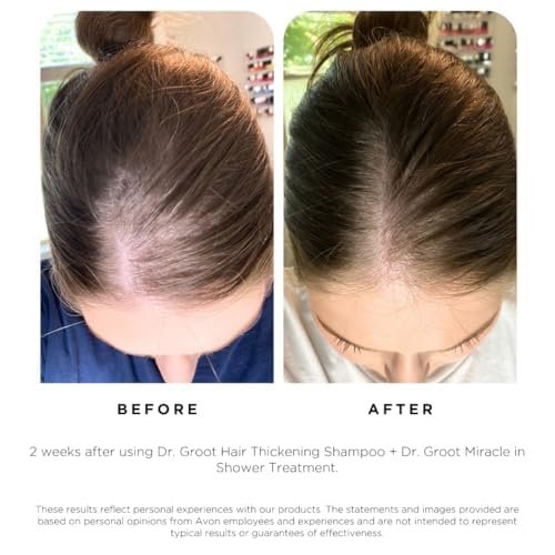 Dr. Groot Hair Thickening Shampoo with Biotin & Rosemary Oil – Korean Hair Care for Volumizing Thinning & Damaged Hair, Hydrating Scalp Revitalizing Solution, 13.01 Fl Oz Avelisse