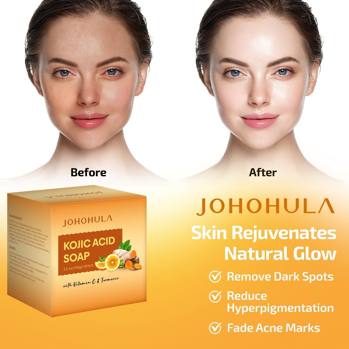 Johohula Kojic Acid Dark Spot Remover Soap Bars with Vitamin C, Retinol, Collagen, Turmeric - Smooth for Face and Body, Firm and Smooth Skin - 3 x 100g Bars - görsel 5