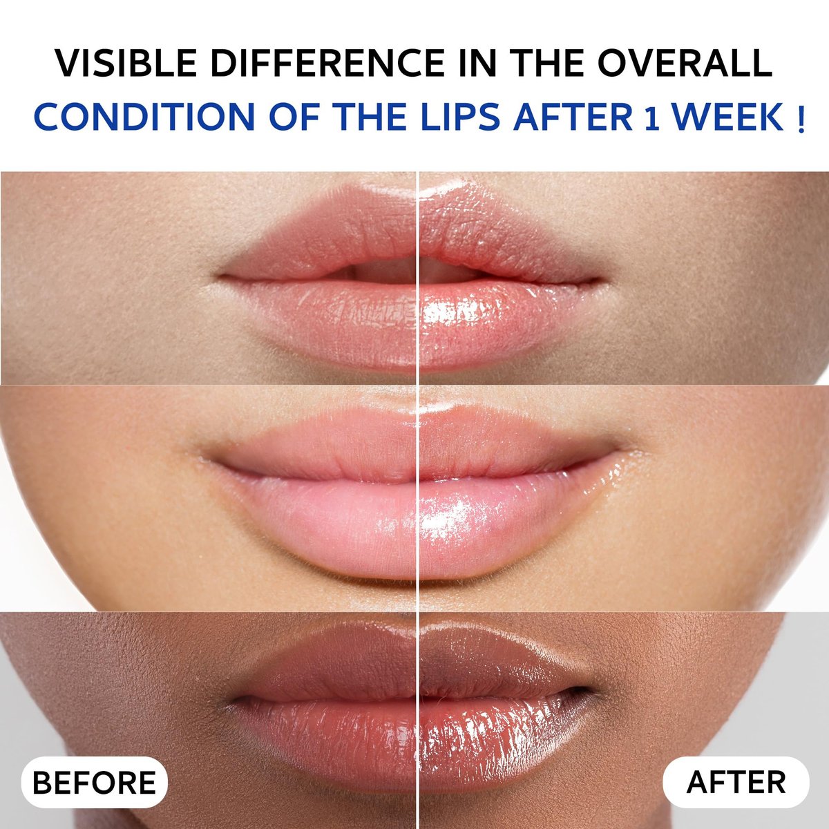 Lip Sleeping Mask (20g) - Collagen Lip Mask Overnight with Hyaluronic Acid & Peptide Complex for Lip Wrinkle Repair and Plumping, Natural Hydration for Smooth Lips Avelisse