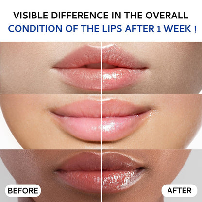 Lip Sleeping Mask (20g) - Collagen Lip Mask Overnight with Hyaluronic Acid & Peptide Complex for Lip Wrinkle Repair and Plumping, Natural Hydration for Smooth Lips Avelisse