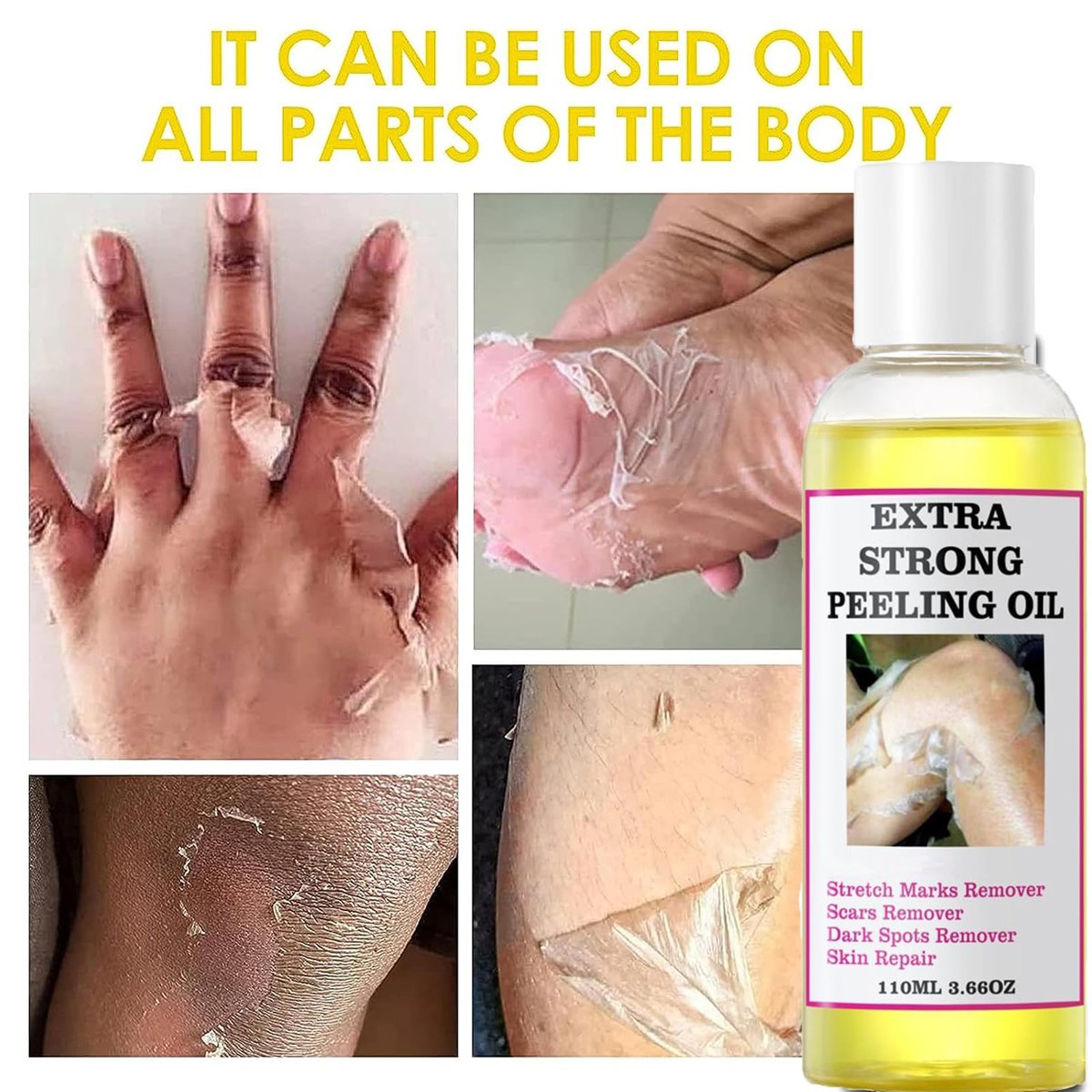 Yellow Peeling Oil for Dark Skin - Extra Strength Strong Peeling Gel Exfoliating Solution for Body, All Skin Types Dead Skin Remover (3.87 Fl Oz / 110ML) - görsel 14