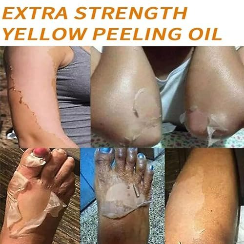 Yellow Peeling Oil for Dark Skin - Extra Strength Strong Peeling Gel Exfoliating Solution for Body, All Skin Types Dead Skin Remover (3.87 Fl Oz / 110ML) - görsel 15