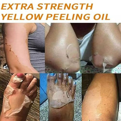 Yellow Peeling Oil for Dark Skin - Extra Strength Strong Peeling Gel Exfoliating Solution for Body, All Skin Types Dead Skin Remover (3.87 Fl Oz / 110ML)