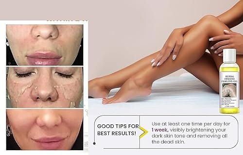 Yellow Peeling Oil for Dark Skin - Extra Strength Strong Peeling Gel Exfoliating Solution for Body, All Skin Types Dead Skin Remover (3.87 Fl Oz / 110ML) - görsel 7