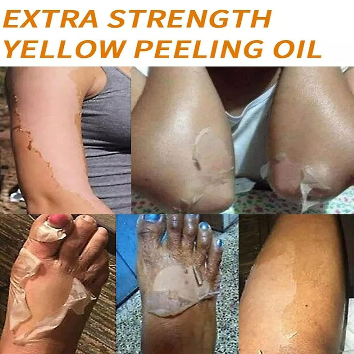 Yellow Peeling Oil for Dark Skin - Extra Strength Strong Peeling Gel Exfoliating Solution for Body, All Skin Types Dead Skin Remover (3.87 Fl Oz / 110ML) - görsel 16