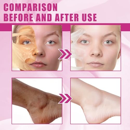 Yellow Peeling Oil for Dark Skin - Extra Strength Strong Peeling Gel Exfoliating Solution for Body, All Skin Types Dead Skin Remover (3.87 Fl Oz / 110ML) - görsel 3