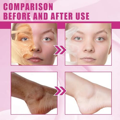 Yellow Peeling Oil for Dark Skin - Extra Strength Strong Peeling Gel Exfoliating Solution for Body, All Skin Types Dead Skin Remover (3.87 Fl Oz / 110ML)