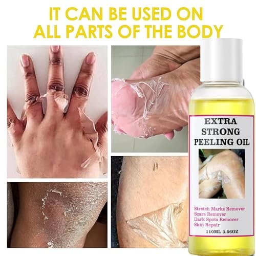 Yellow Peeling Oil for Dark Skin - Extra Strength Strong Peeling Gel Exfoliating Solution for Body, All Skin Types Dead Skin Remover (3.87 Fl Oz / 110ML) - görsel 13