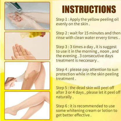 Yellow Peeling Oil for Dark Skin - Extra Strength Strong Peeling Gel Exfoliating Solution for Body, All Skin Types Dead Skin Remover (3.87 Fl Oz / 110ML)